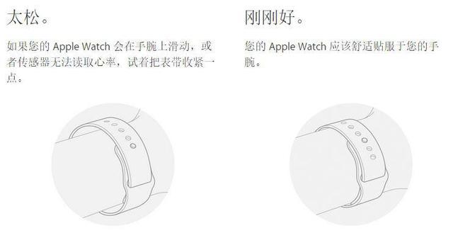 苹果回应Apple Watch刺激皮肤：佩戴方式不当