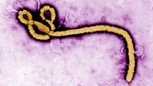 美国医生感染埃博拉后痊愈 眼中再检出埃博拉病毒