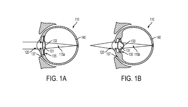 植入眼球 谷歌申请人工晶状体装置专利