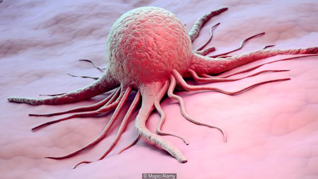 科学家提出癌症进化疗法：利用癌细胞自相残杀